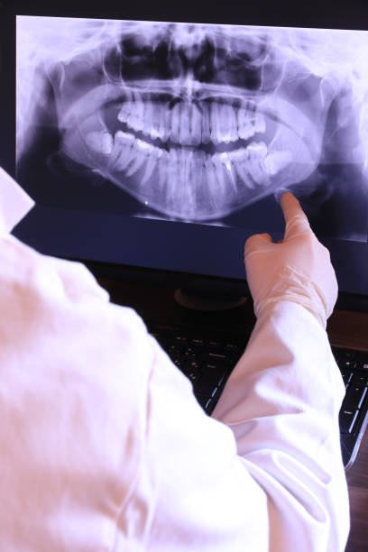 Best Emergency Treatment for Dental Infections or Abscesses in Plymouth, MN